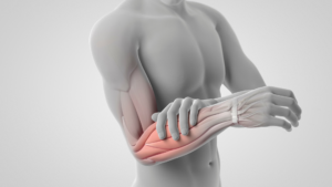 arm and shoulder pain