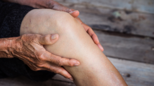 osteoarthritis in knee