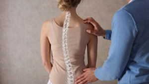 woman with degenerative scoliosis