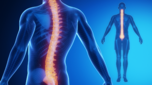 spinal cord stimulation